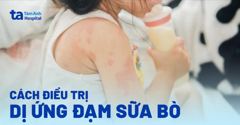 ty le tre tu het di ung dam sua bo theo do tuoi